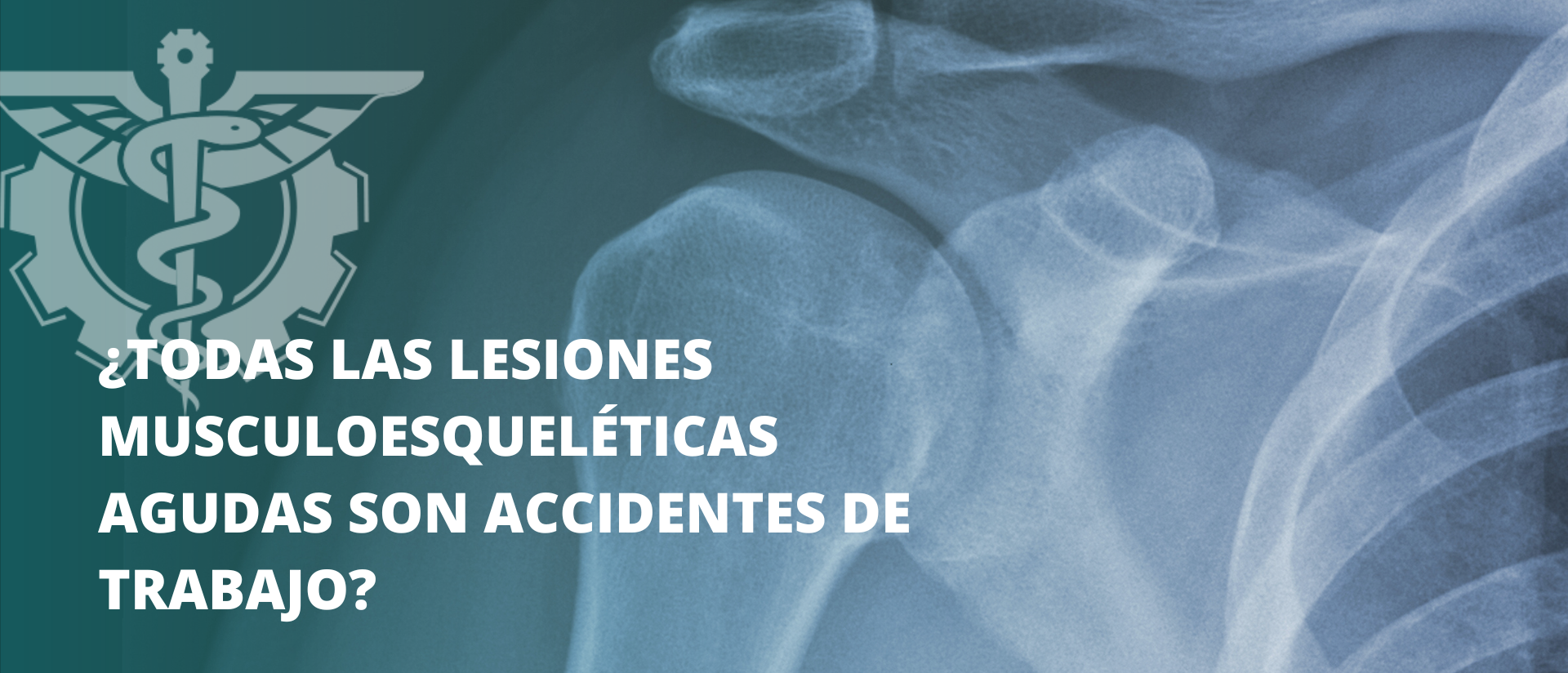 Caso de estudio: ¿Todas las lesiones musculoesqueléticas agudas son accidentes de trabajo?